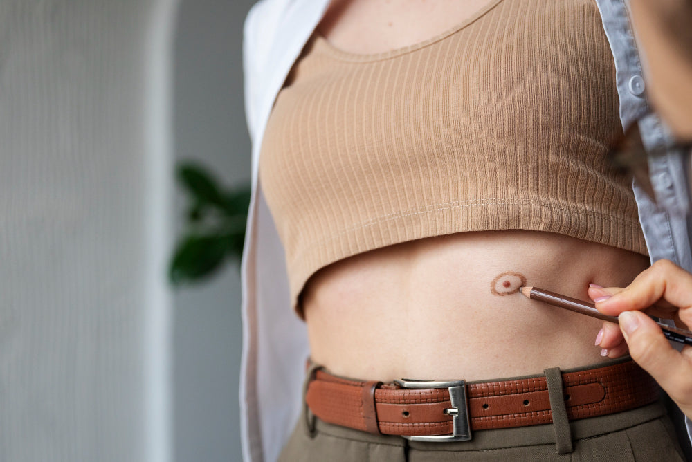 การดูแลตัวเองที่บ้านสำหรับผู้ป่วยที่ใช้ทวารเทียมหรือ Ostomy เป็นครั้งแรก