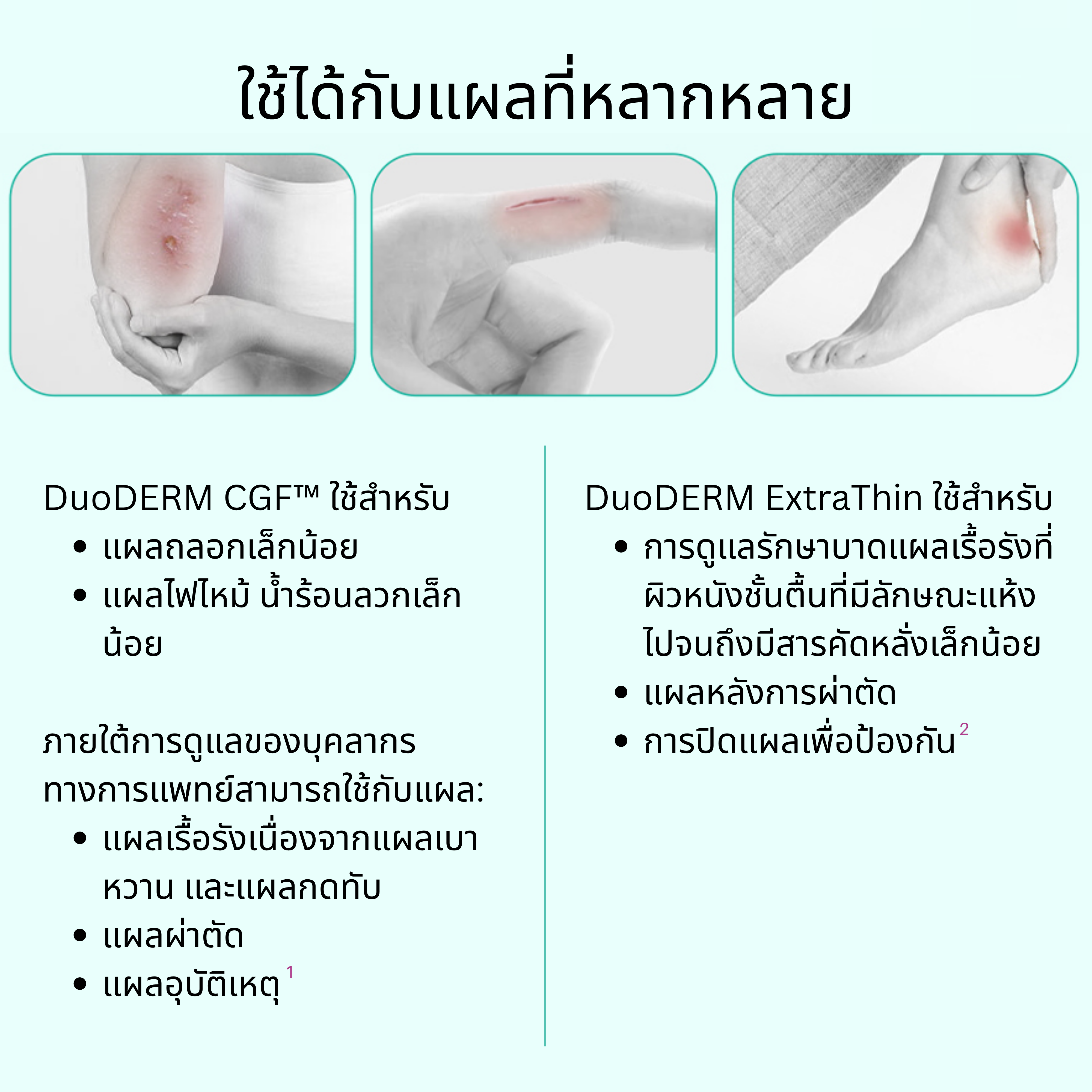 187660 Convatec DUODERM CGF Control Gel Formula Dressing แผ่นปิดแผลดูโอเดิร์มซีจีเอฟ ขนาด 10x10 cm (5 ชิ้น /กล่อง)
